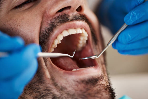 Best Tooth Infection Emergency Dentist  in Palm Springs, FL